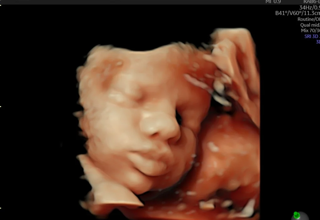 3d ultrasound image