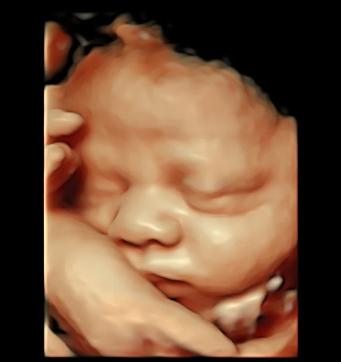 3d ultrasound image