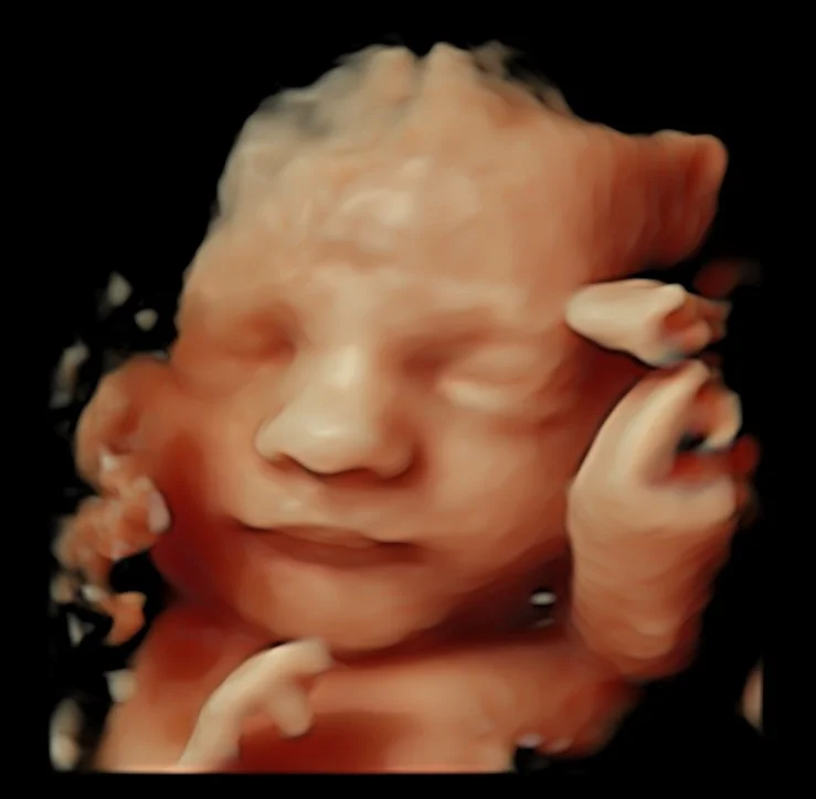 3d ultrasound image