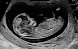 ultrasound image